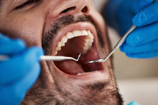 Best Emergency Dentist for Knocked-Out Tooth in Mccormick, SC