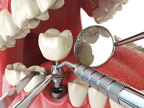 Best Emergency Cosmetic Dentistry in Mccormick, SC